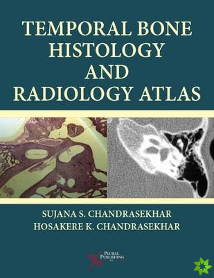 Temporal Bone Histology and Radiology Atlas