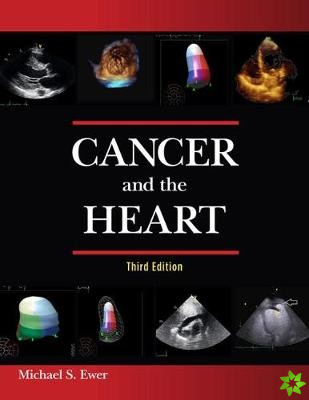 Cancer and the Heart