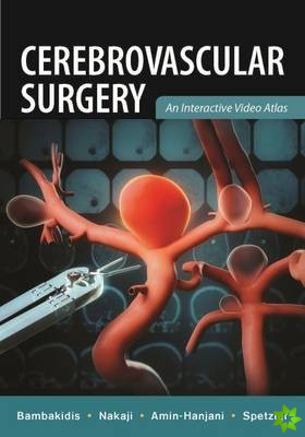Cerebrovascular Surgery: An Interactive Video Atlas