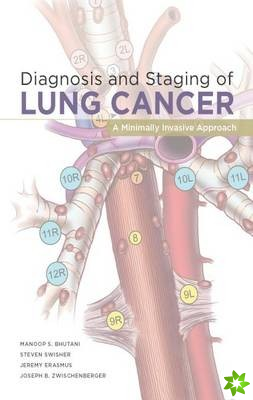 Diagnosis and Staging of Lung Cancer: A Minimally Invasive Approach
