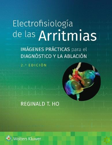 Electrofisiologia de las arritmias