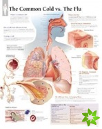 Common Cold vs the Flu Laminated Poster