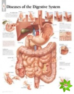 Diseases of the Digestive System Laminated Poster