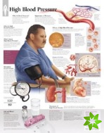 High Blood Pressure Laminated Poster