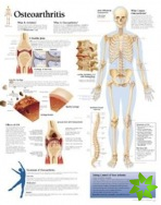 Osteoarthritis Paper Poster