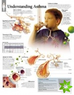 Understanding Asthma Laminated Poster