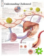 Understanding Cholesterol Laminated Poster