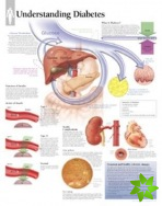 Understanding Diabetes Paper Poster