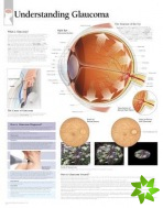 Understanding Glaucoma Paper Poster