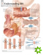 Understanding IBS Paper Poster
