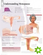 Understanding Menopause Laminated Poster