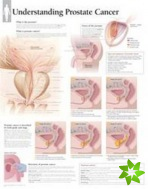 Understanding Prostate Cancer Paper Poster