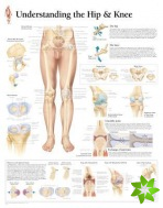 Understanding the Hip & Knee Laminated Poster