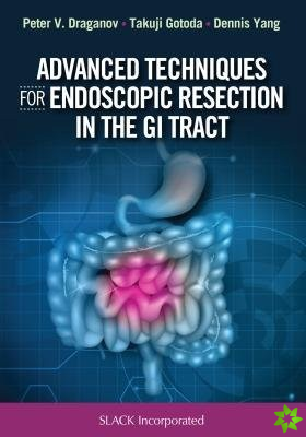 Advanced Techniques for Endoscopic Resection in the GI Tract