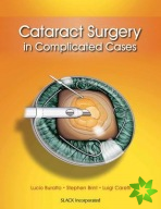 Cataract Surgery in Complicated Cases