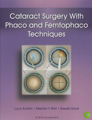 Cataract Surgery with Phaco and Femtophaco Techniques