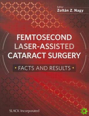 Femtosecond Laser-Assisted Cataract Surgery