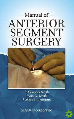 Manual of Anterior Segment Surgery