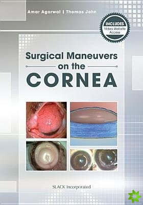 Mastering Corneal Surgery