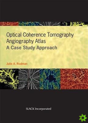 Optical Coherence Tomography Angiography Atlas