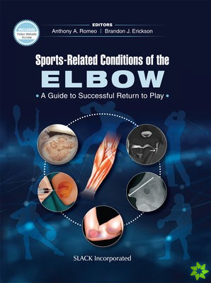 Sports-Related Conditions of the Elbow
