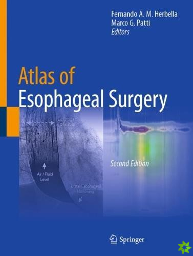Atlas of Esophageal Surgery