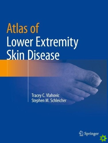 Atlas of Lower Extremity Skin Disease