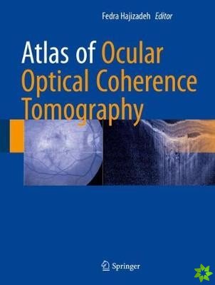 Atlas of Ocular Optical Coherence Tomography