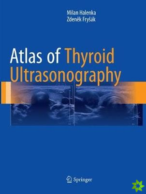 Atlas of Thyroid Ultrasonography