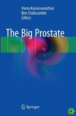 Big Prostate