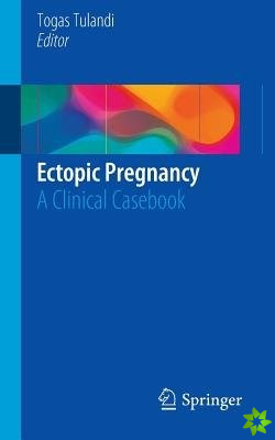 Ectopic Pregnancy