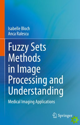 Fuzzy Sets Methods in Image Processing and Understanding
