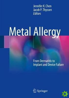 Metal Allergy