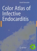 Color Atlas of Infective Endocarditis