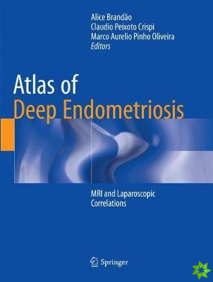 Atlas of Deep Endometriosis