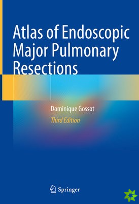 Atlas of Endoscopic Major Pulmonary Resections