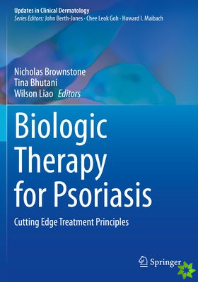 Biologic Therapy for Psoriasis