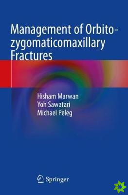Management of Orbito-zygomaticomaxillary Fractures