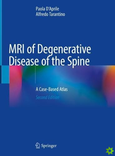 MRI of Degenerative Disease of the Spine