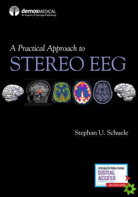 Practical Approach to Stereo EEG