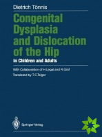 Congenital Dysplasia and Dislocation of the Hip in Children and Adults