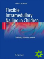 Flexible Intramedullary Nailing in Children