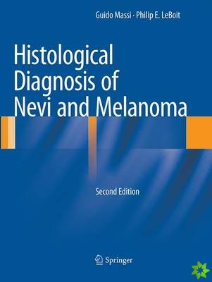 Histological Diagnosis of Nevi and Melanoma