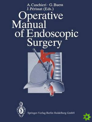 Operative Manual of Endoscopic Surgery