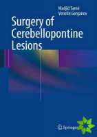 Surgery of Cerebellopontine Lesions