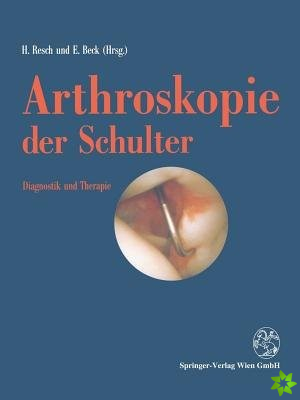 Arthroskopie der Schulter