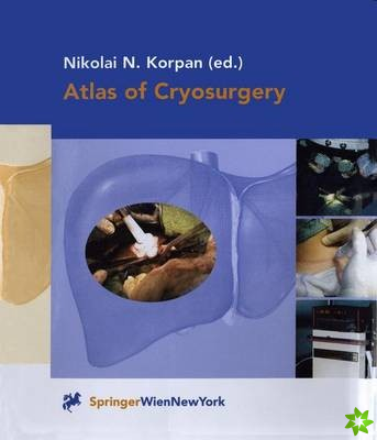 Atlas of Cryosurgery
