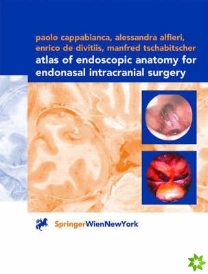 Atlas of Endoscopic Anatomy for Endonasal Intracranial Surgery