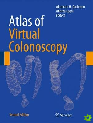 Atlas of Virtual Colonoscopy