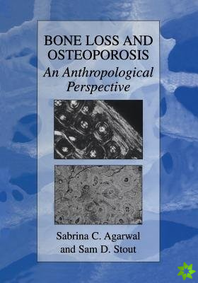 Bone Loss and Osteoporosis